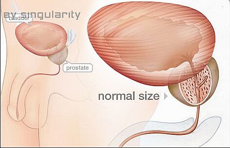 Enlarged Prostate (BPH) Symptoms and Treatment