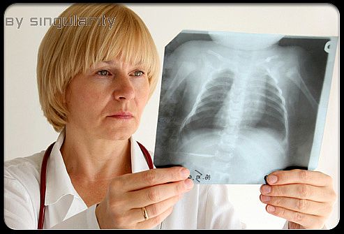 A doctor looks at a chest X-ray of a patient with asthma. 