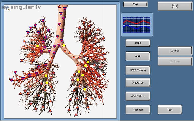 Bioplasm  analysis diseases of lower parts of respiratory system